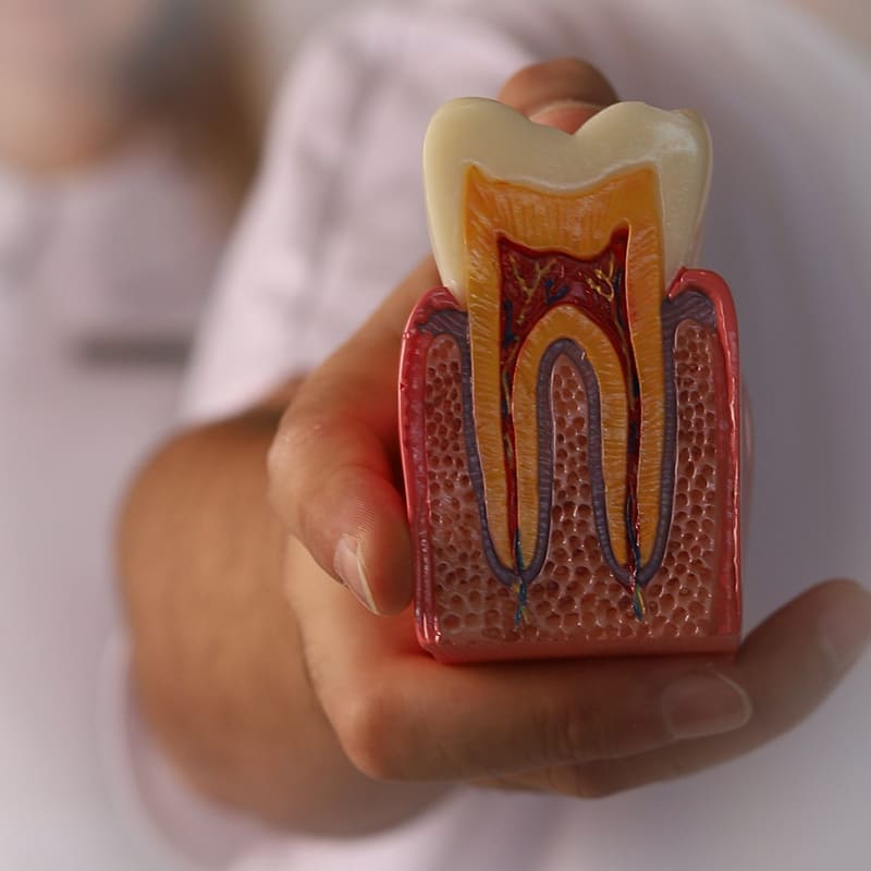 Безболезненное удаление зубов